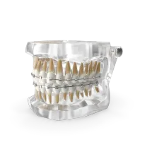 Консультация ортодонта