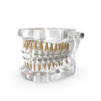 Консультация ортодонта